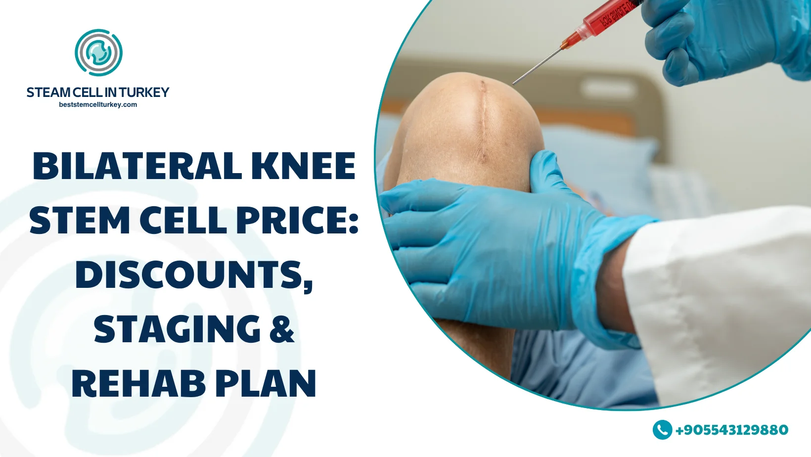 Bilateral Knee Stem Cell Price