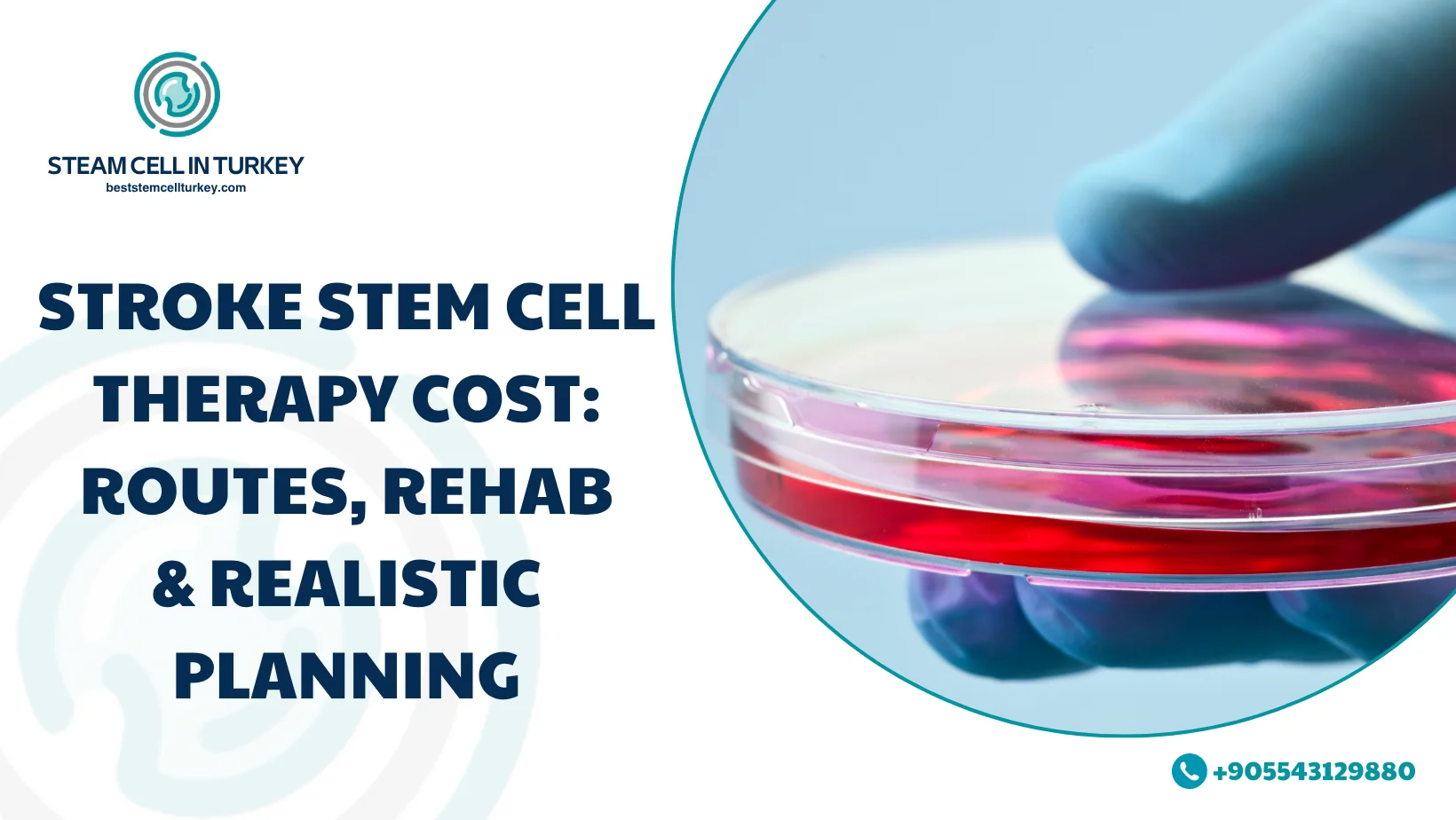 Stroke Stem Cell Therapy Cost