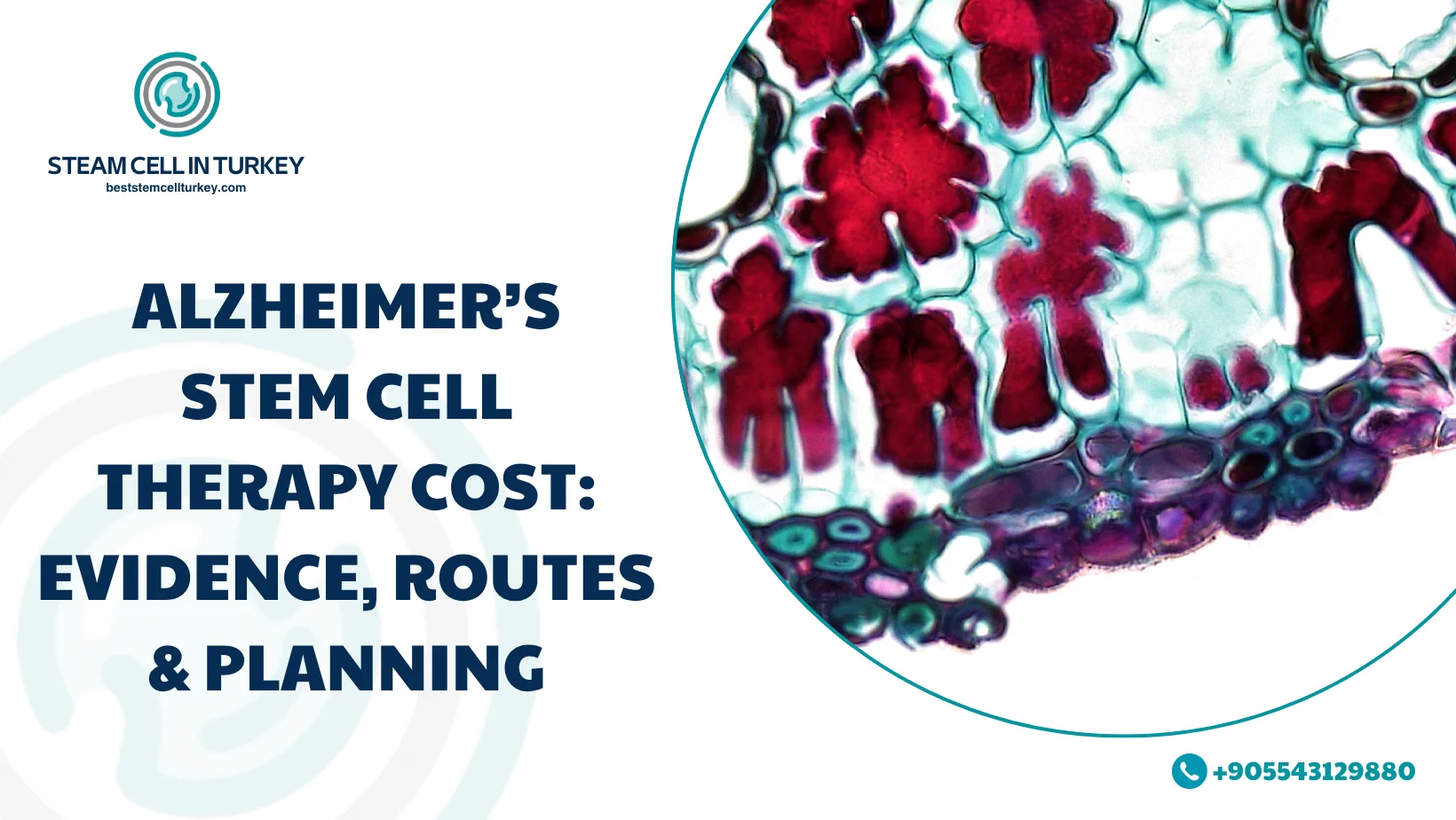 Alzheimer’s Stem Cell Therapy Cost