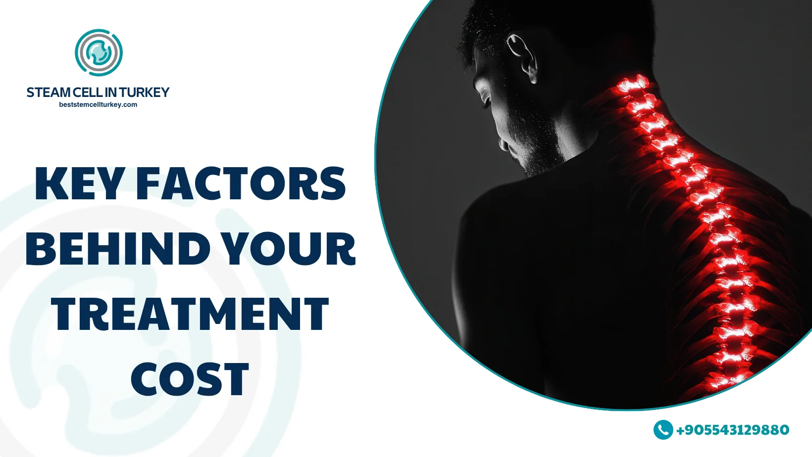 Spinal Cord Injury Stem Cell Therapy Cost