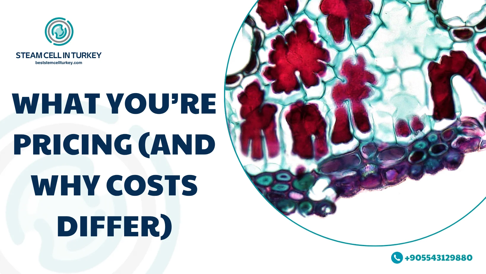 Alzheimer’s Stem Cell Therapy Cost