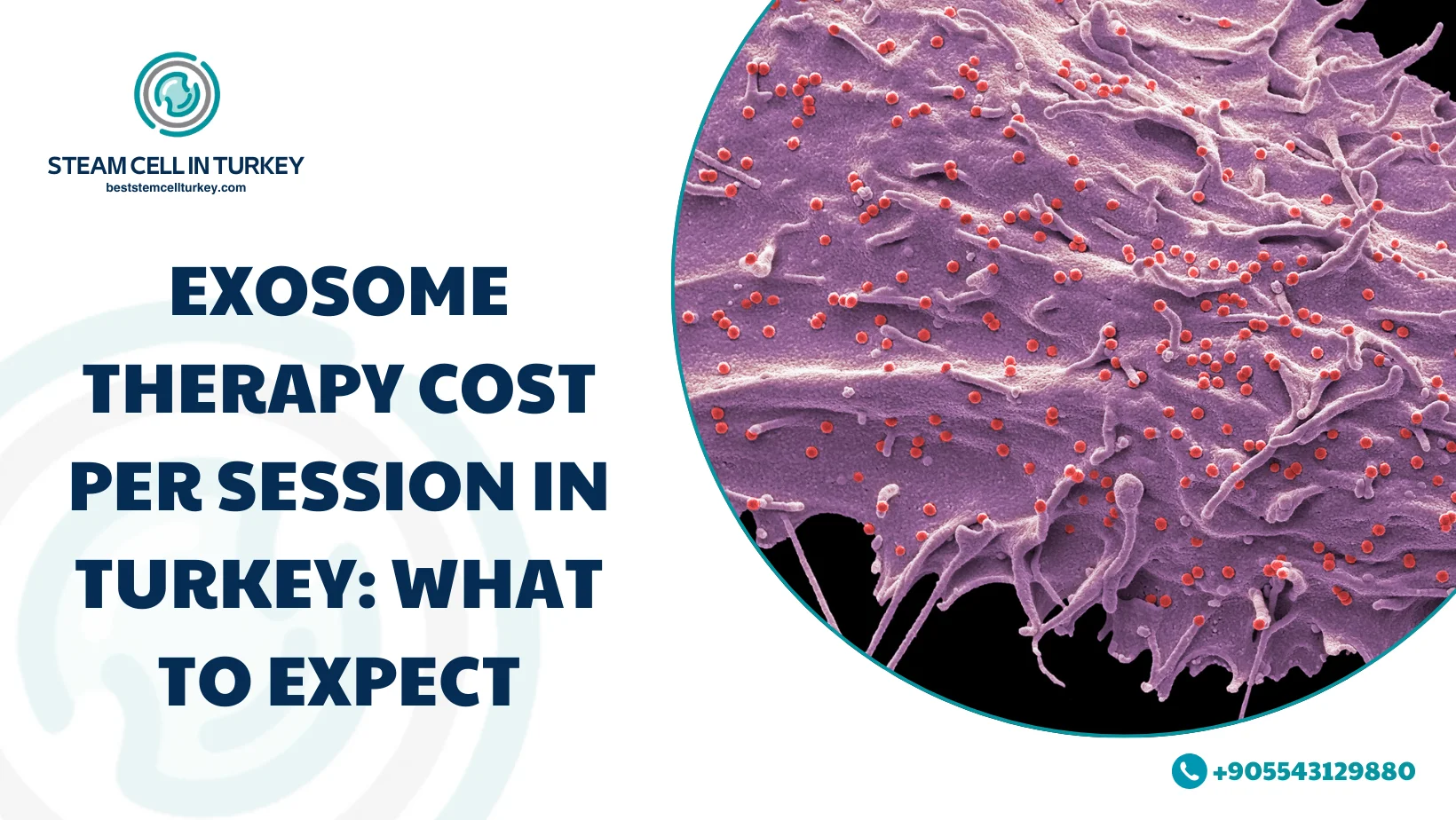 Exosome Therapy Cost per Session