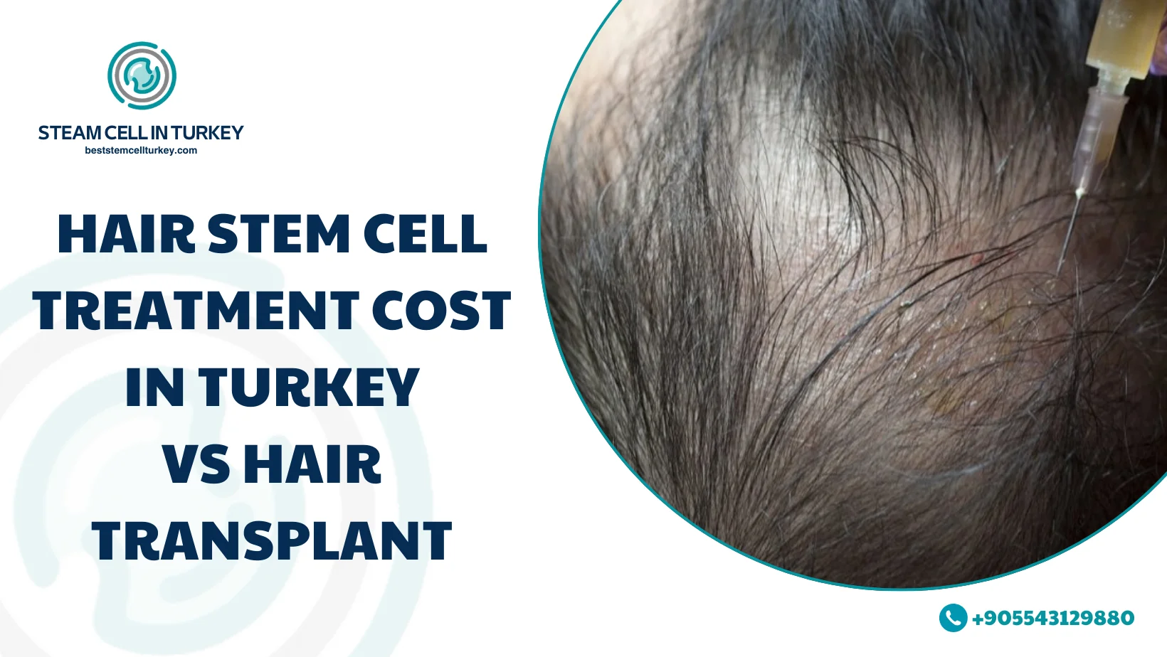 hair stem cell treatment cost