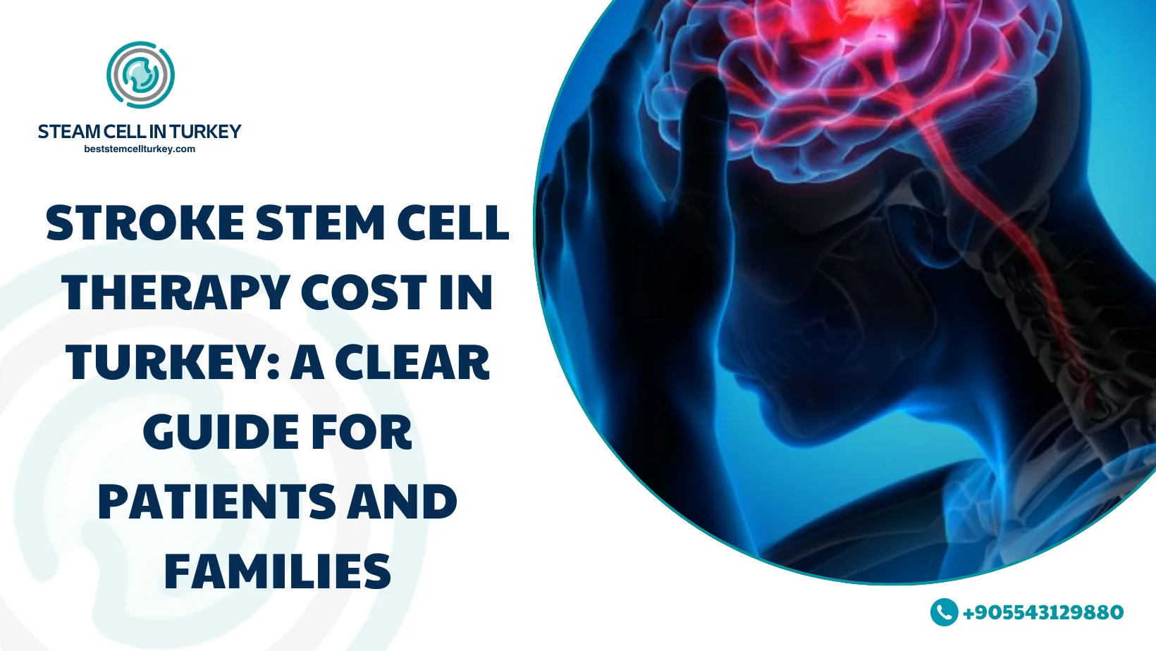 Stroke Stem Cell Therapy Cost