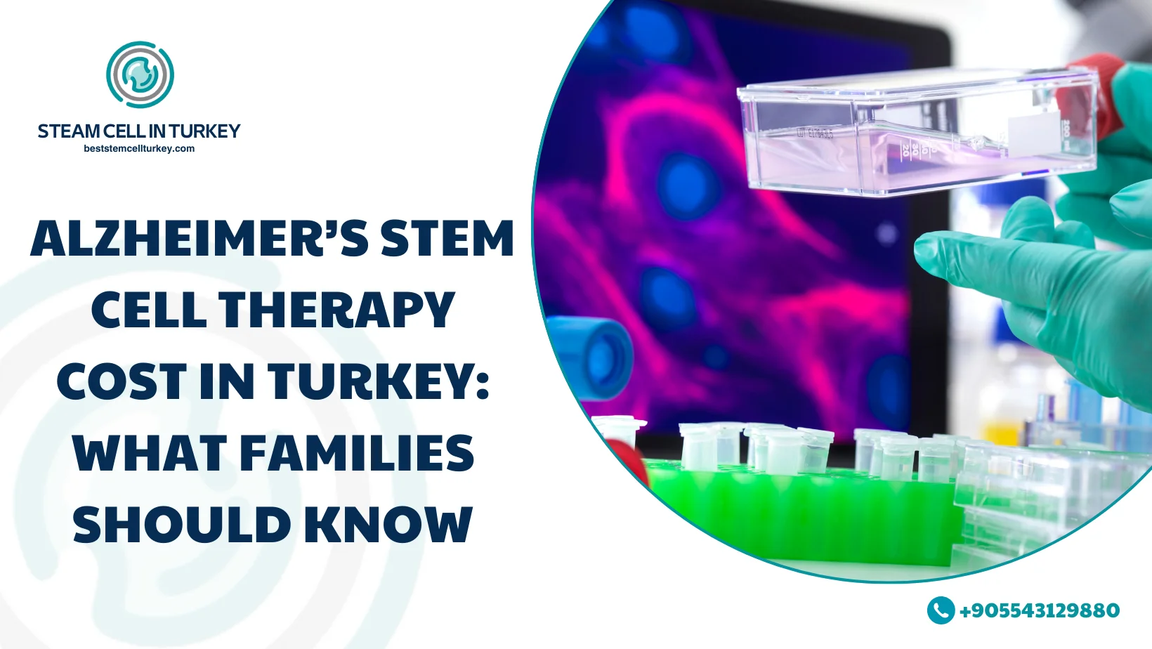 Alzheimer’s Stem Cell Therapy Cost