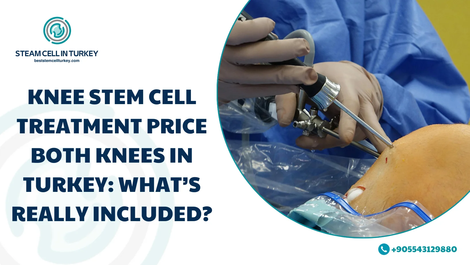 knee stem cell treatment price both knees