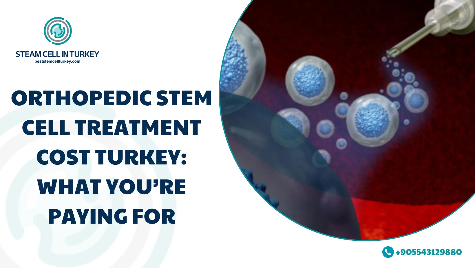 Orthopedic Stem Cell Treatment Cost Turkey