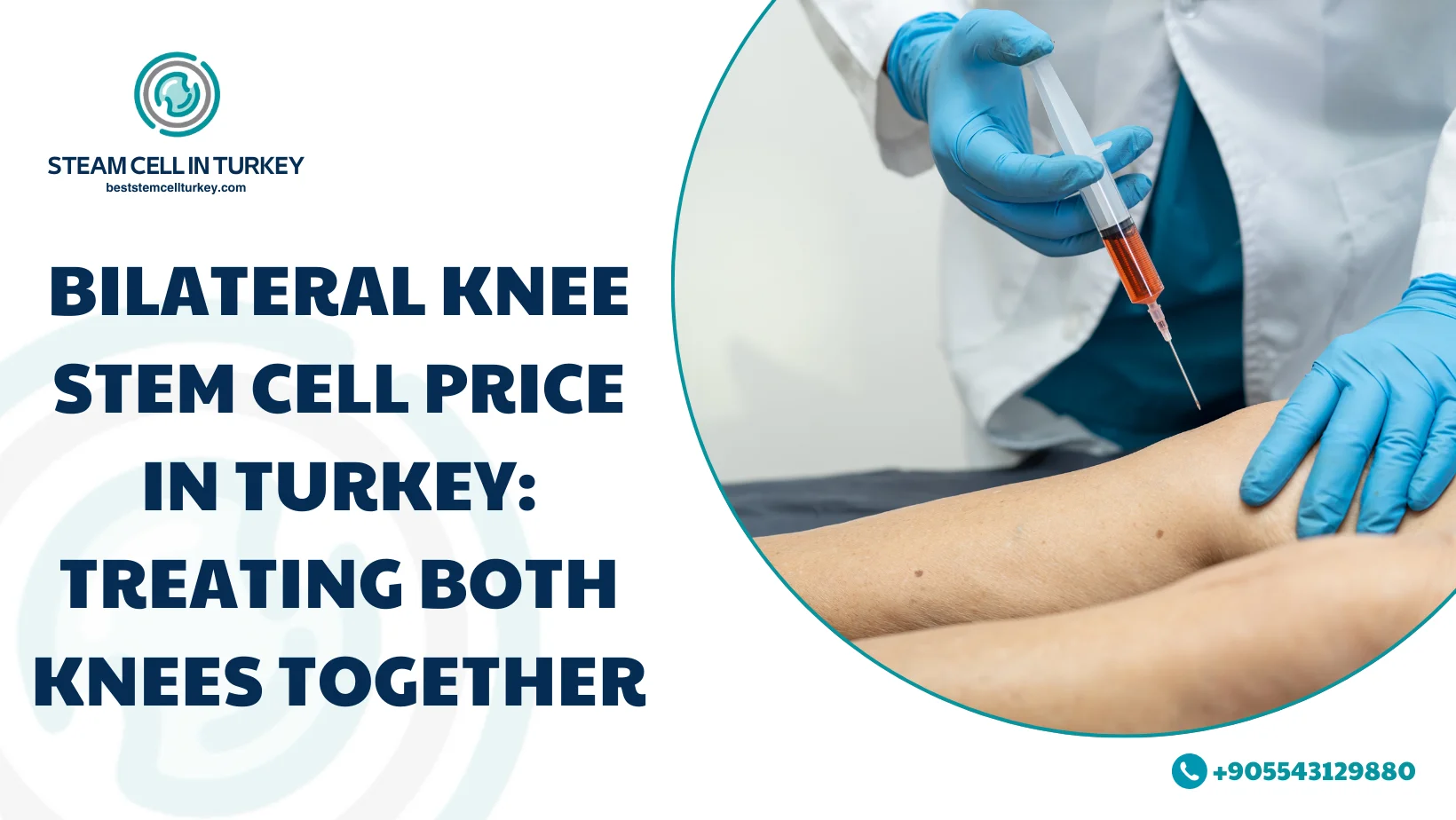 Bilateral Knee Stem Cell Price