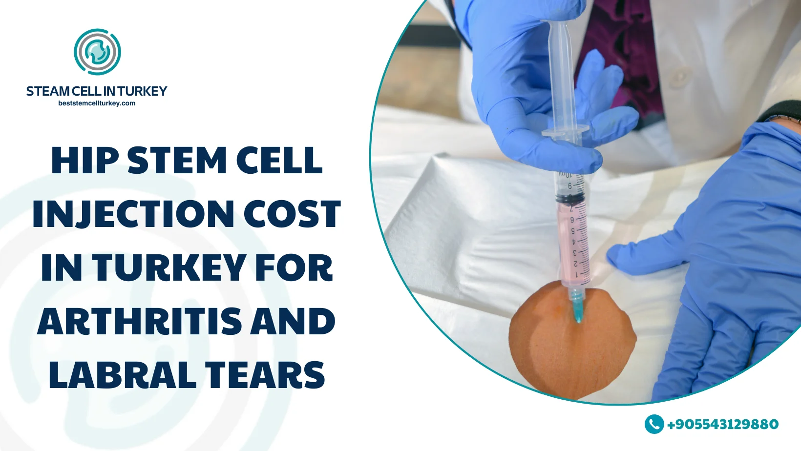 hip stem cell injection cost