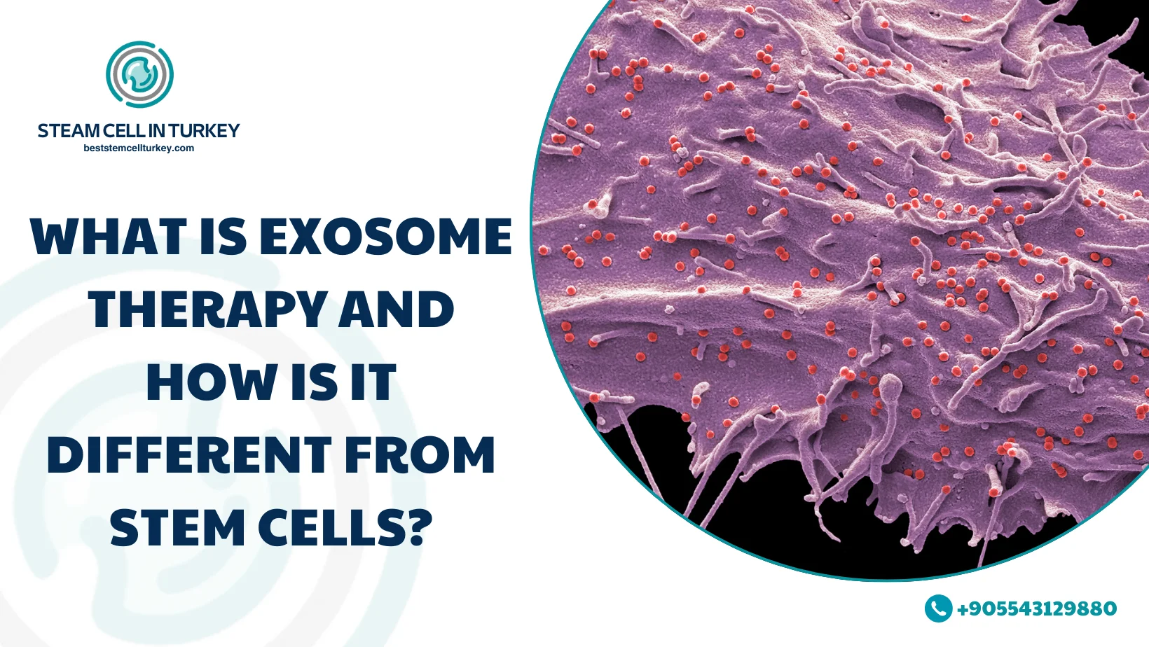 Exosome Therapy Cost per Session