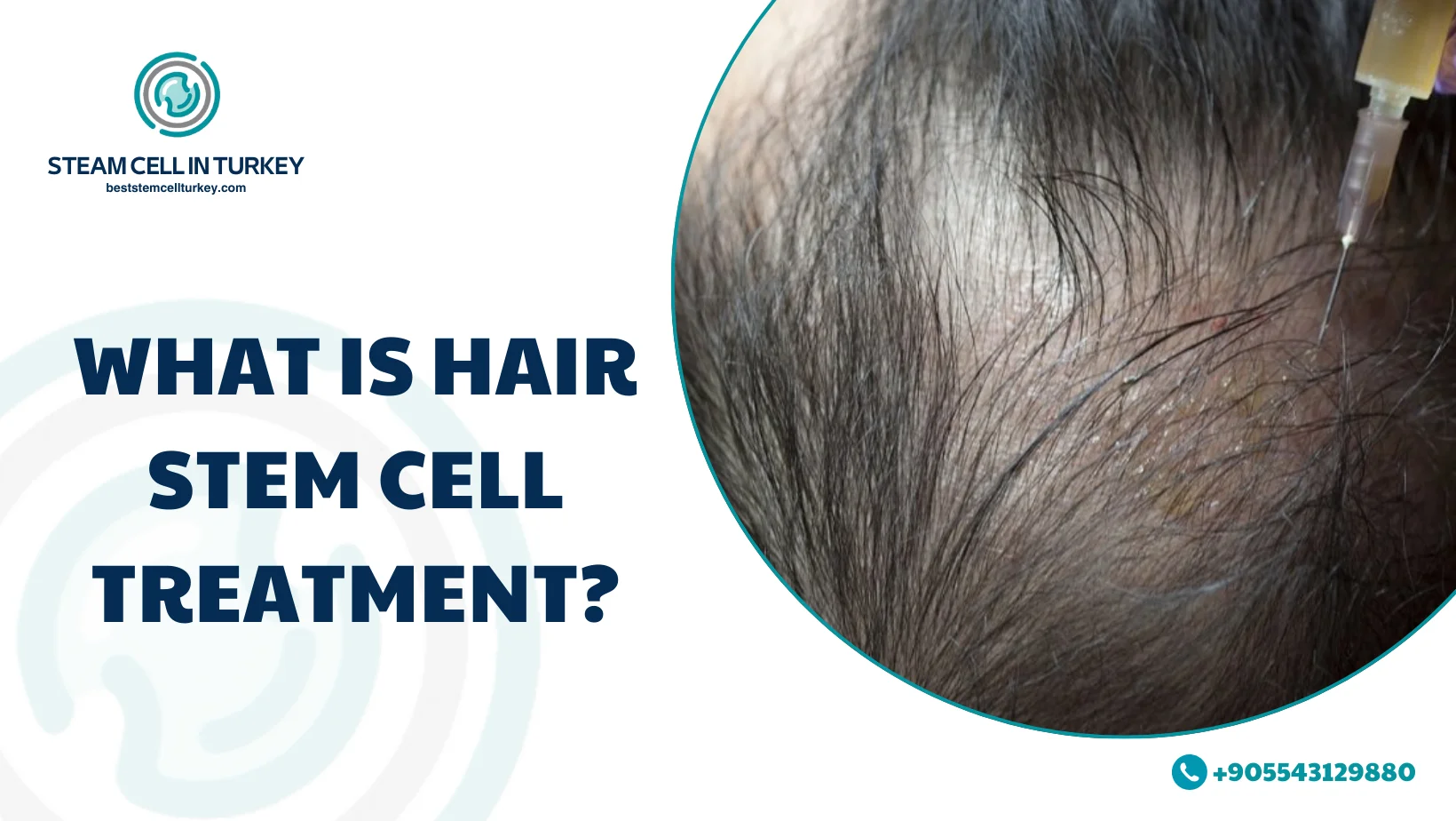 hair stem cell treatment cost