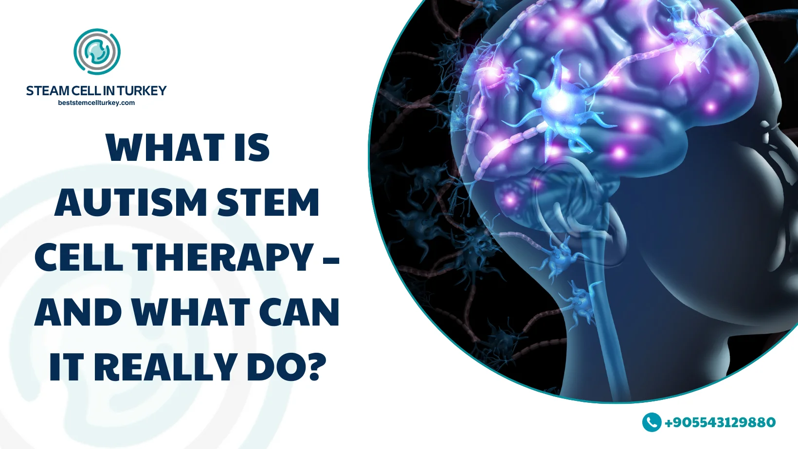 Autism Stem Cell Therapy Cost