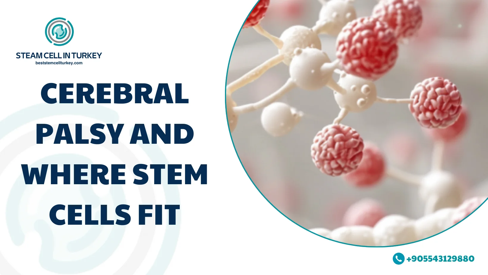 Cerebral Palsy Stem Cell Therapy Cost