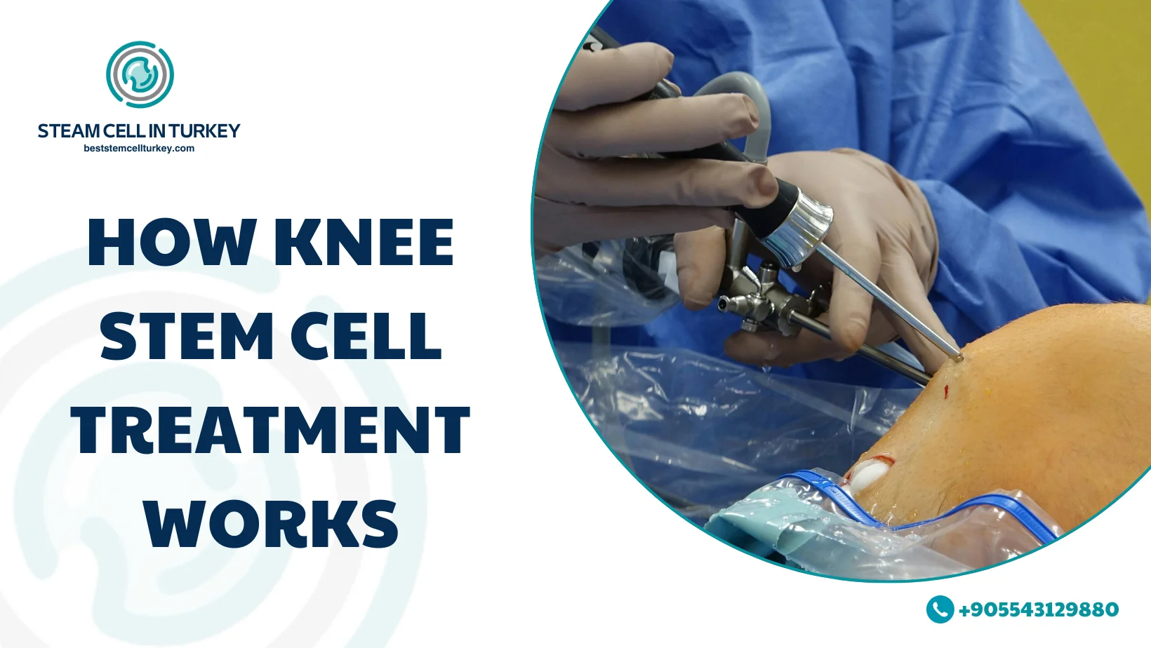 knee stem cell treatment price both knees