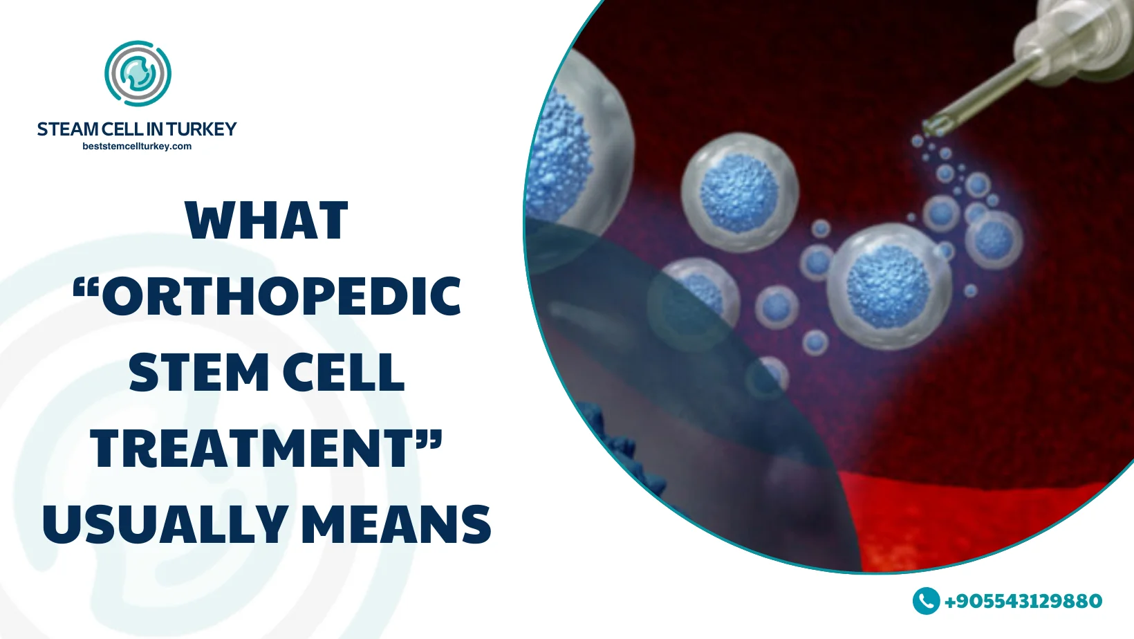 Orthopedic Stem Cell Treatment Cost Turkey