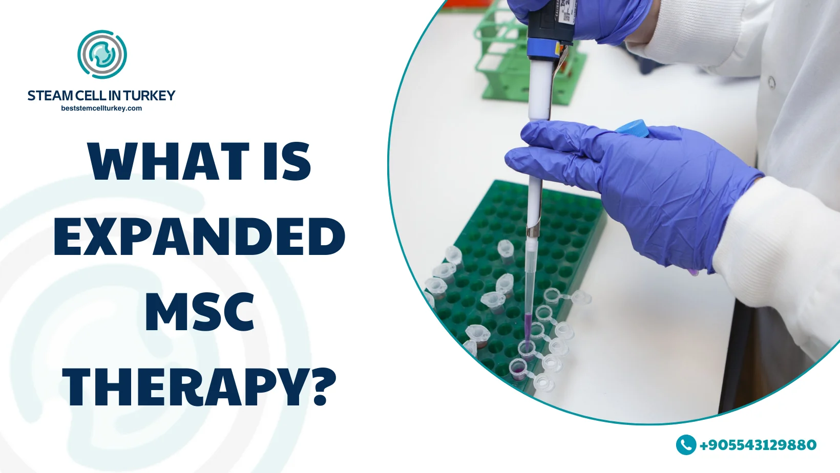 expanded MSC therapy price