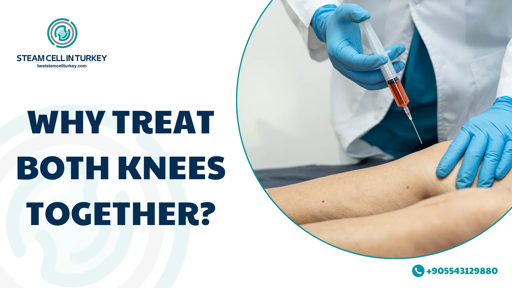 Bilateral Knee Stem Cell Price