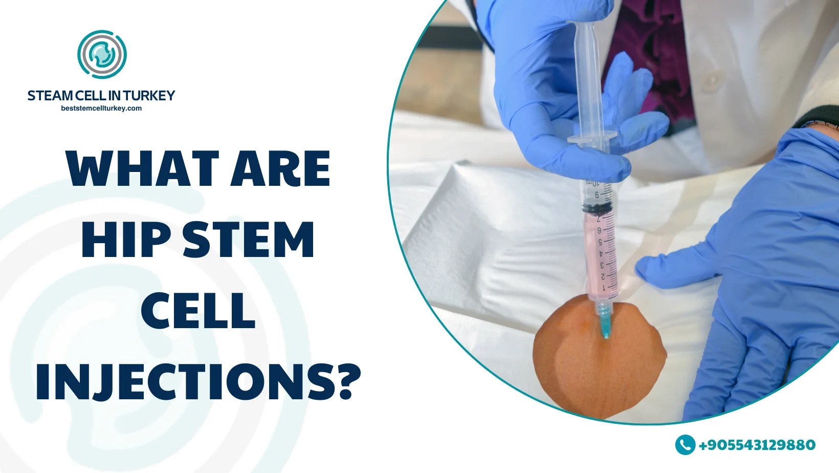 hip stem cell injection cost