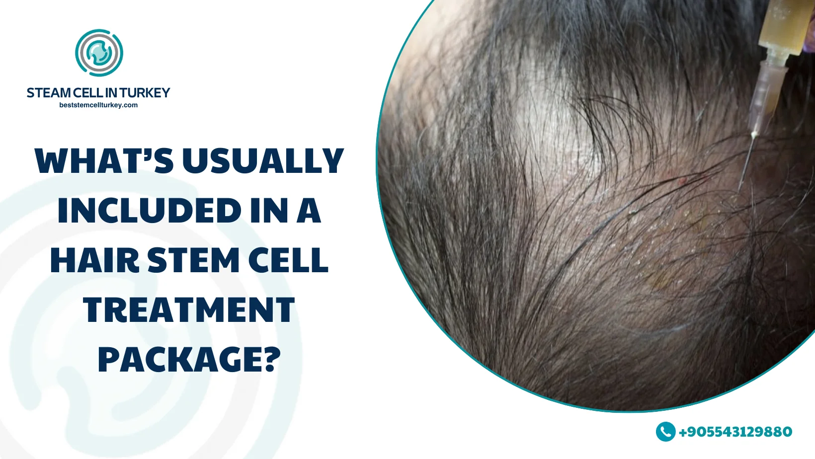 hair stem cell treatment cost