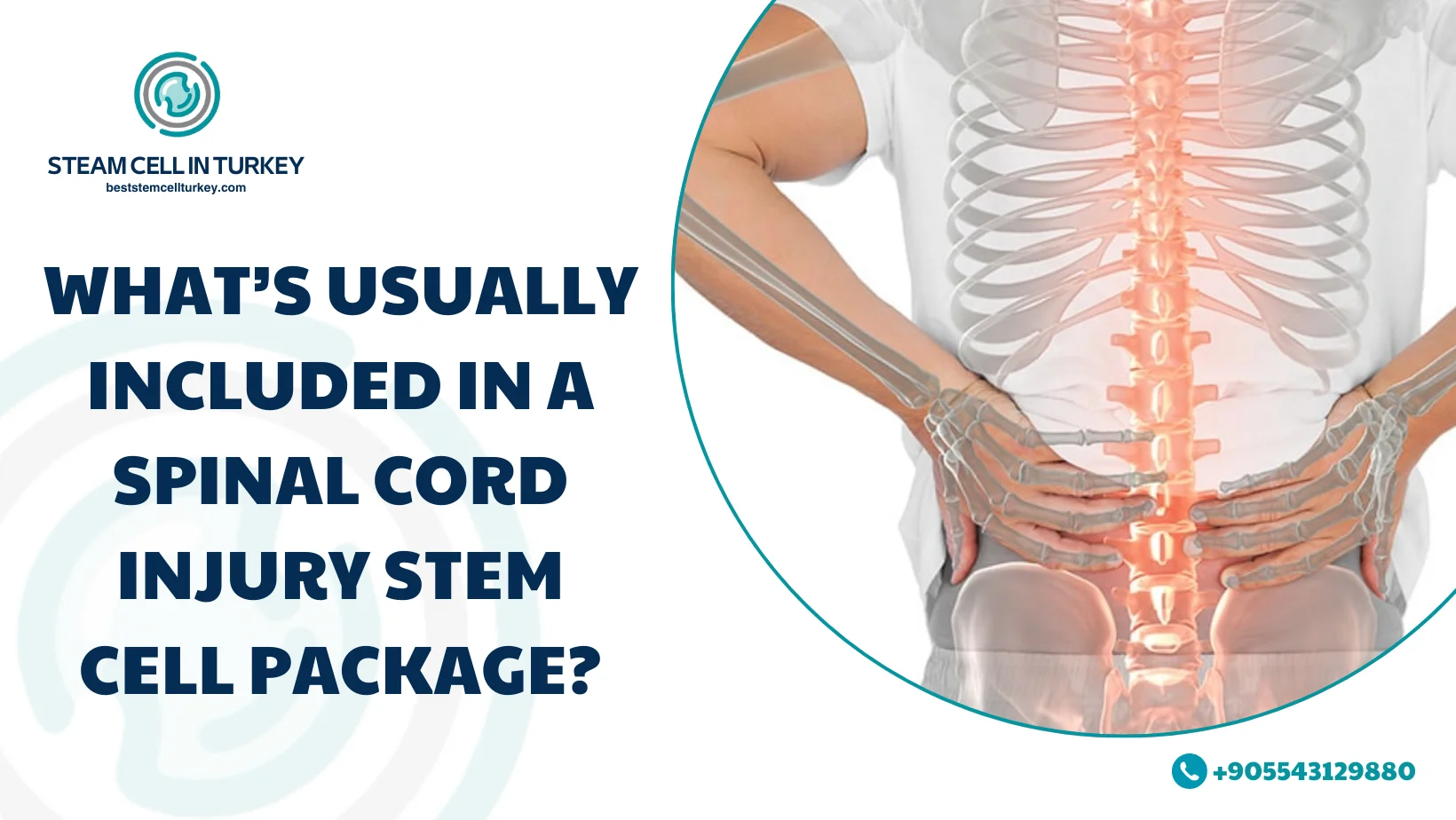 Spinal Cord Injury Stem Cell Therapy Cost