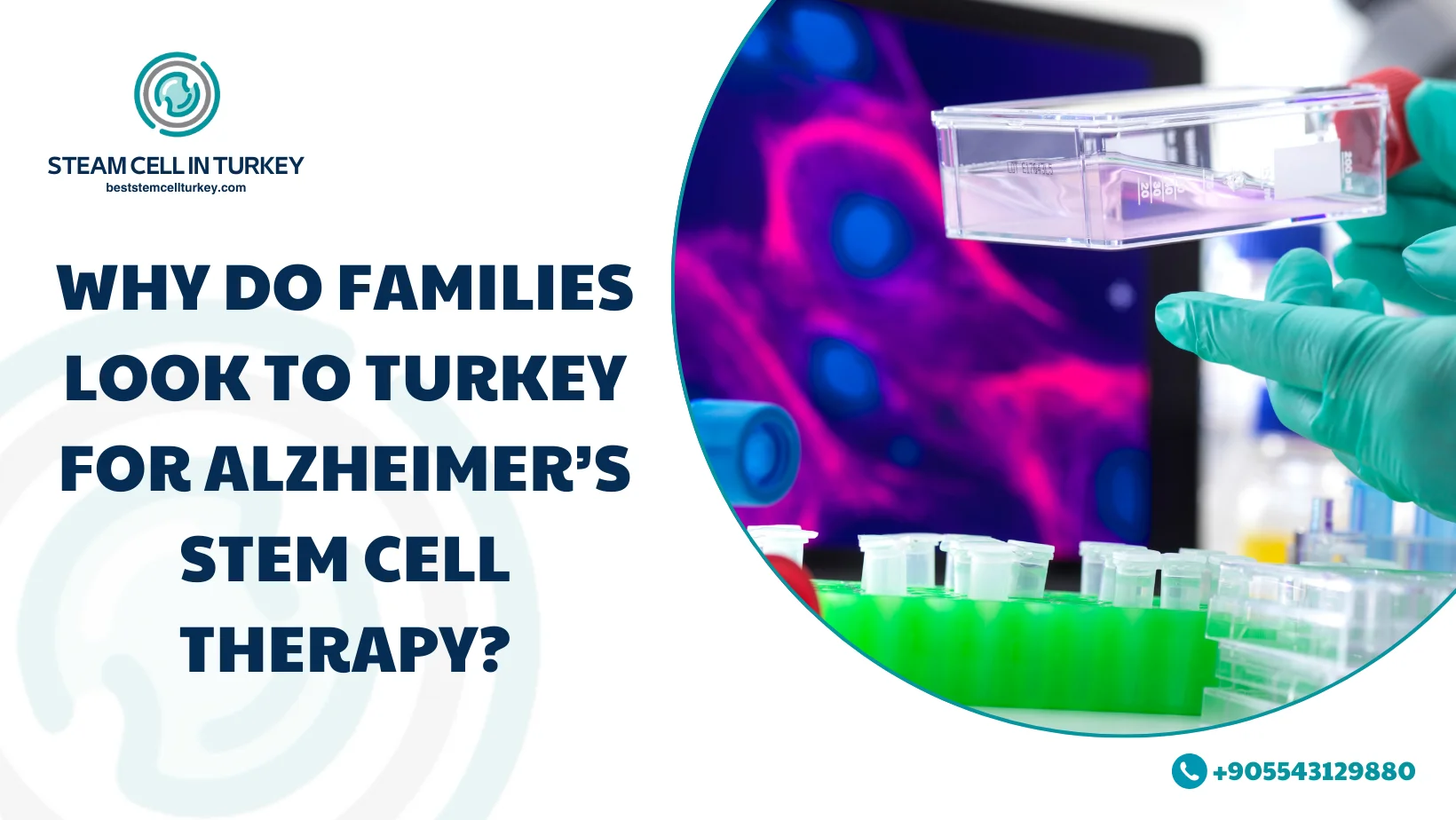 Alzheimer’s Stem Cell Therapy Cost