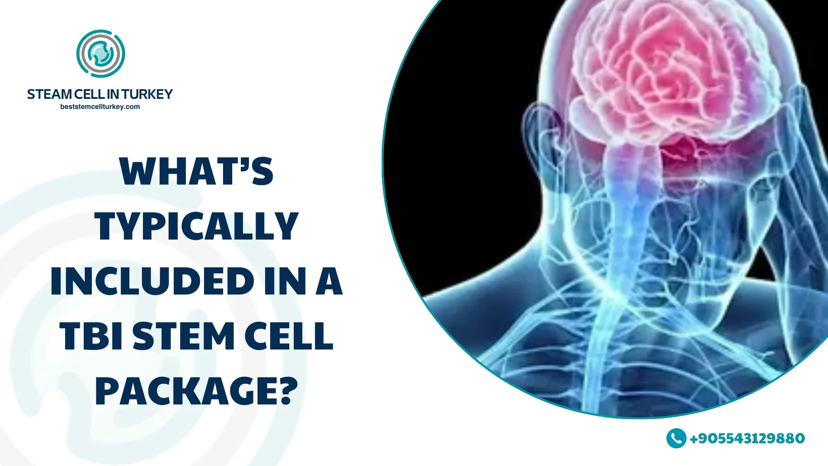 TBI Stem Cell Therapy Cost