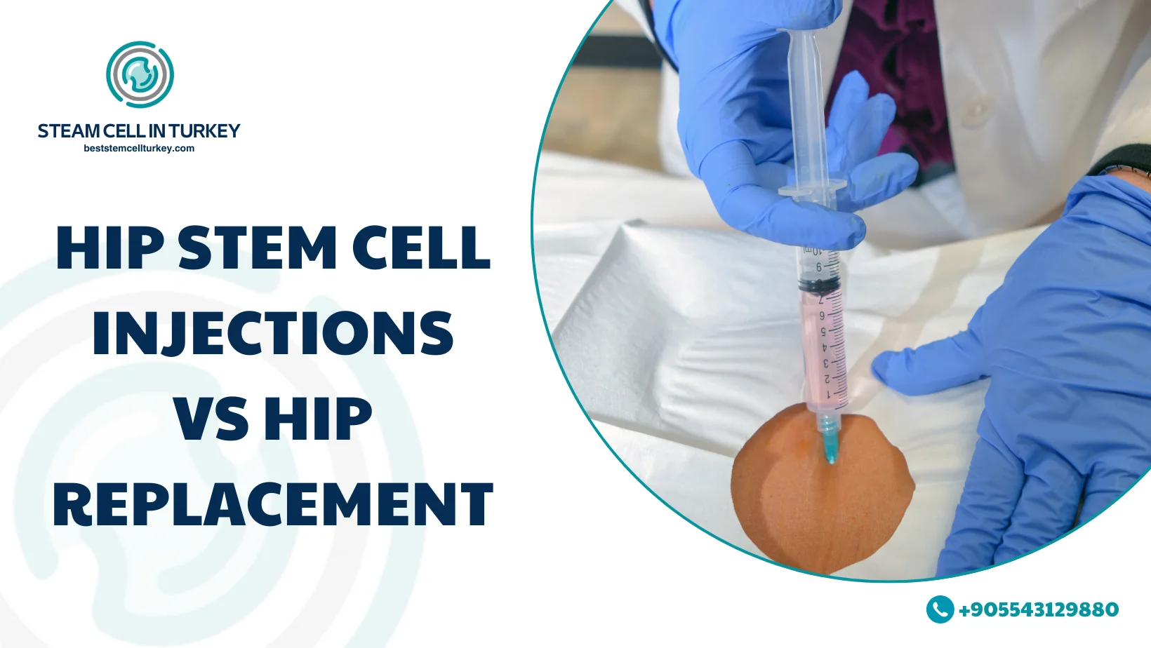hip stem cell injection cost