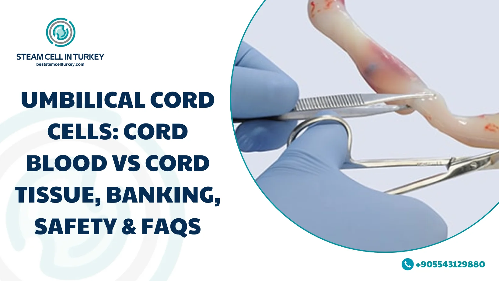 Umbilical cord cells