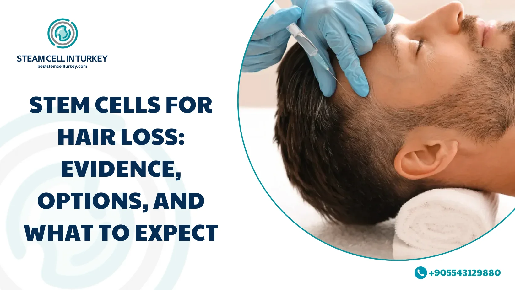 Stem cells for hair loss