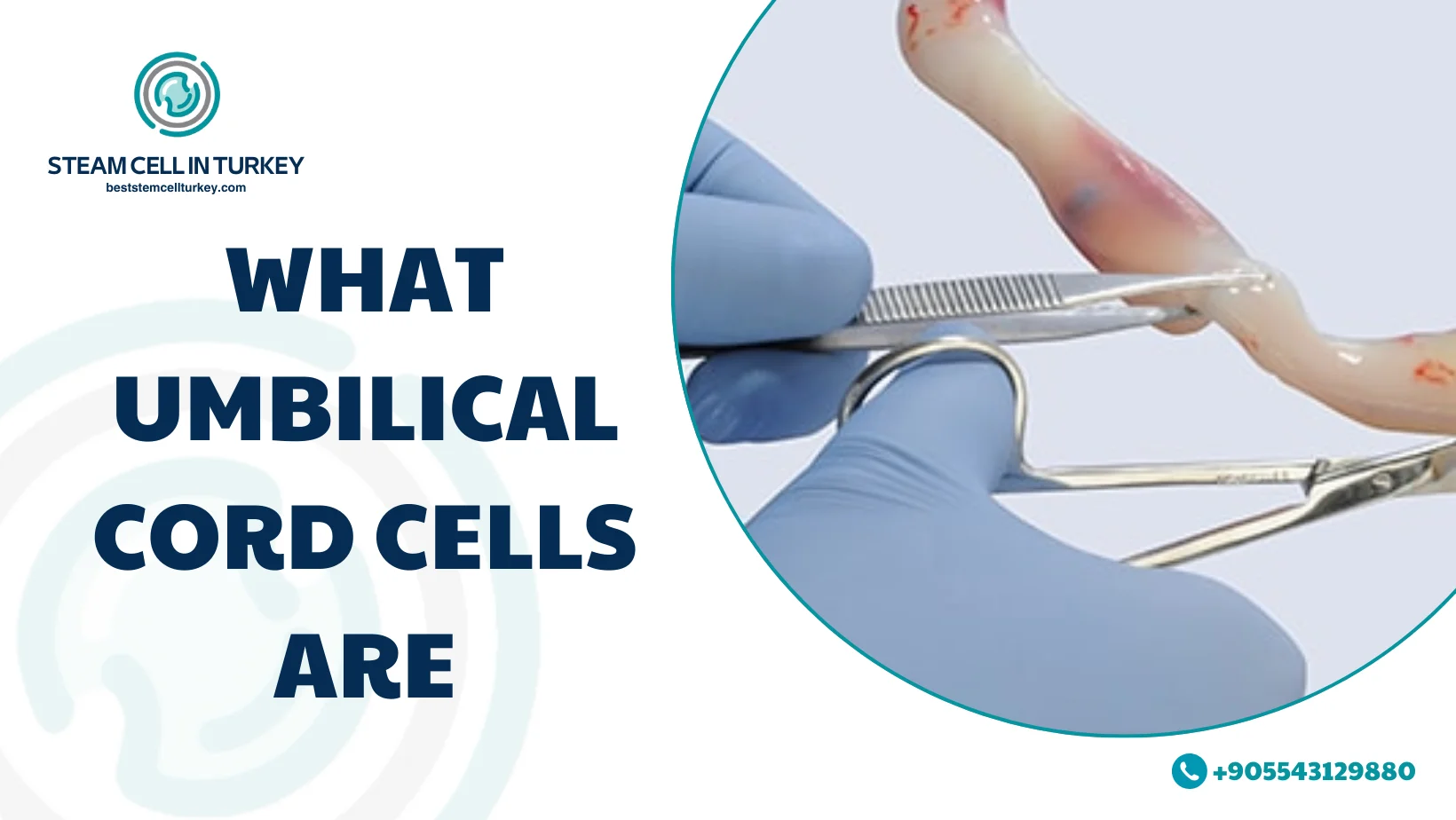 Umbilical cord cells