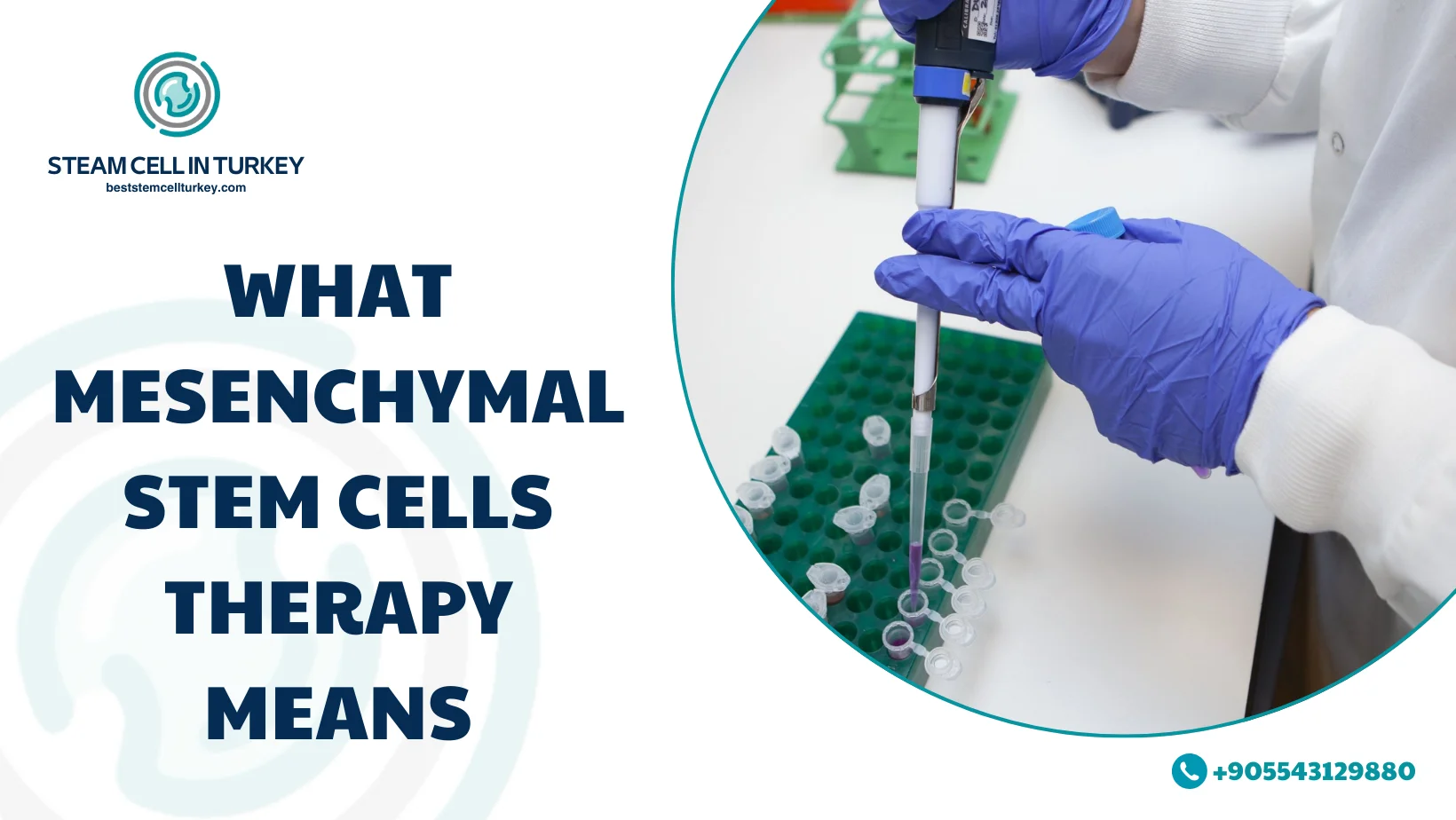 Mesenchymal Stem Cells Therapy