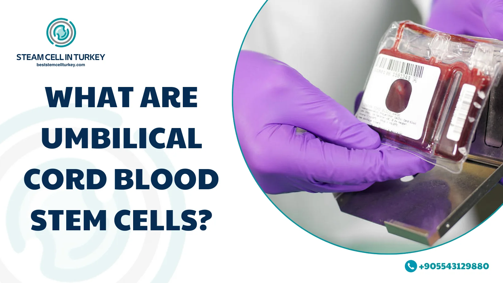Umbilical Cord Blood Stem Cells