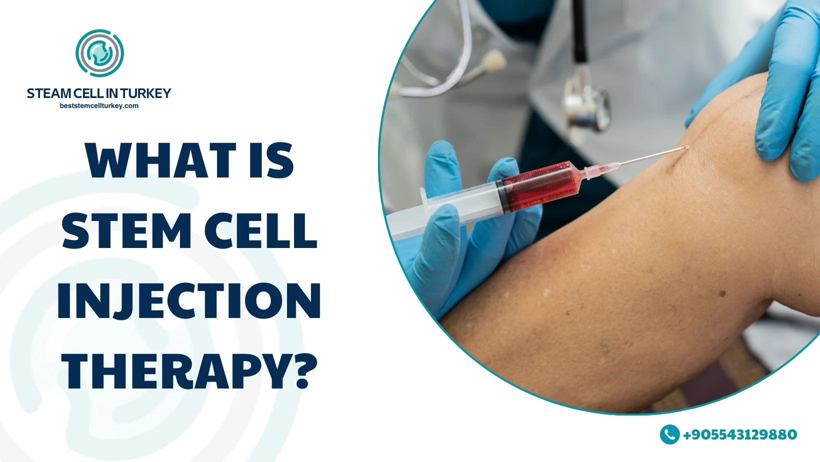 stem cell injection therapy