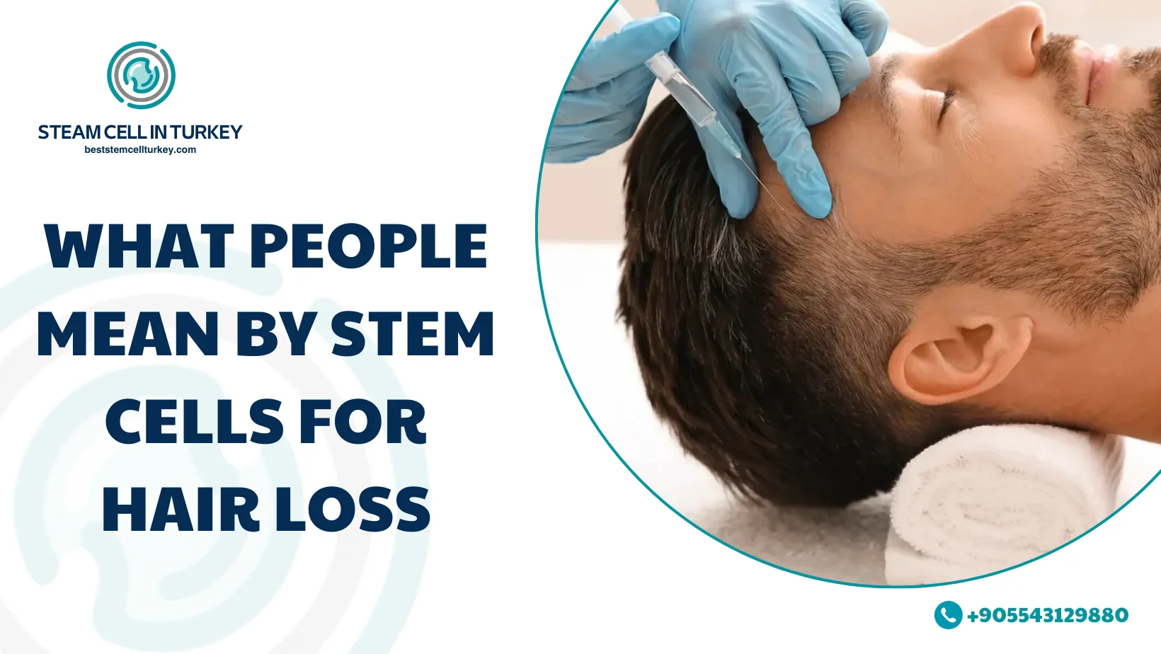 Stem cells for hair loss
