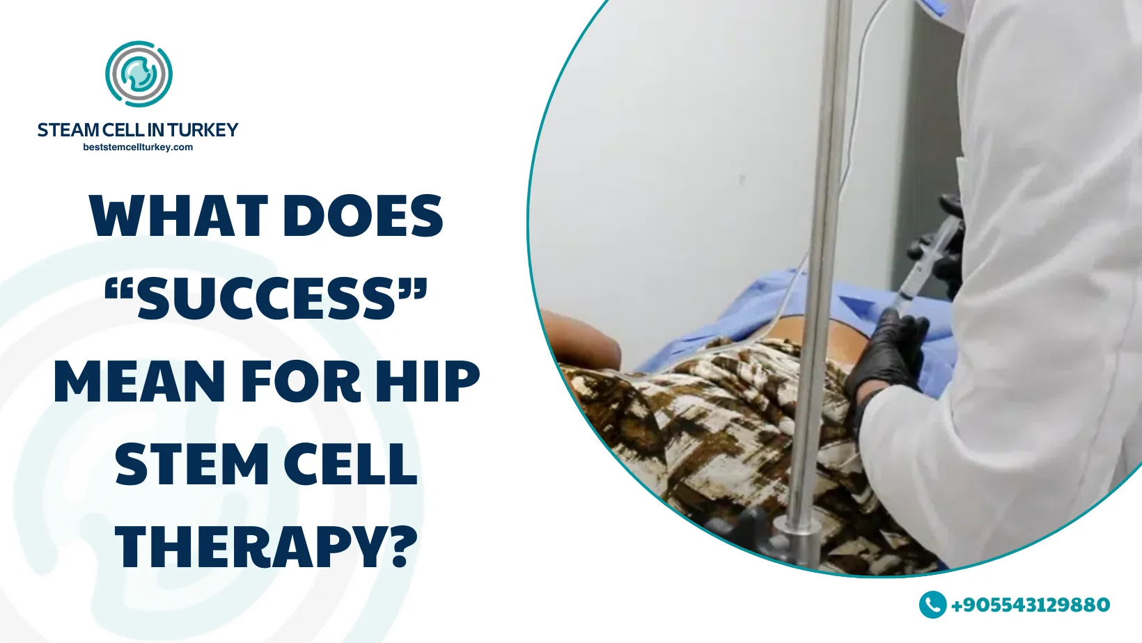 Success Rate of Stem Cell Therapy for Hips