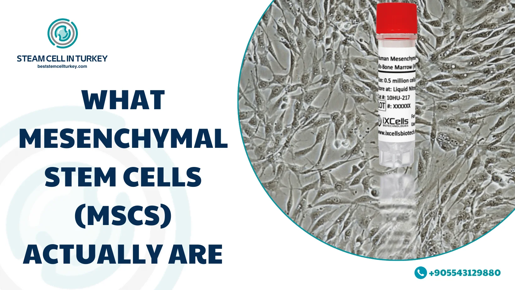 Mesenchymal Stem Cells MSCs