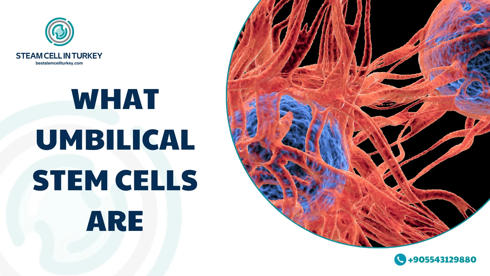 Umbilical stem cells
