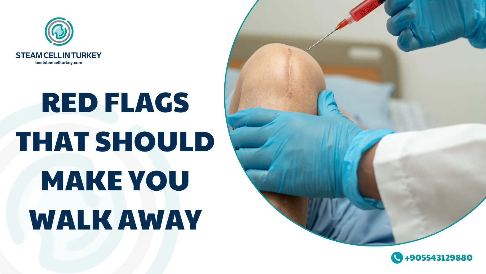 Success Rate of Stem Cell Therapy for Knees